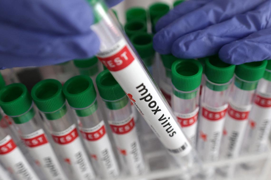 Senegal reports mpox case, patient in isolation