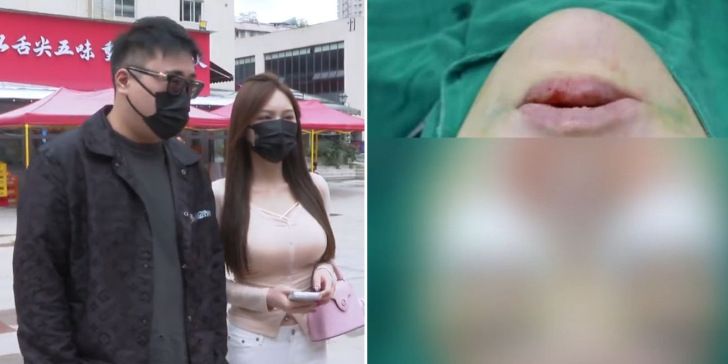 Man in China gives girlfriend over s$180k for safekeeping, she spends it on cosmetic surgery