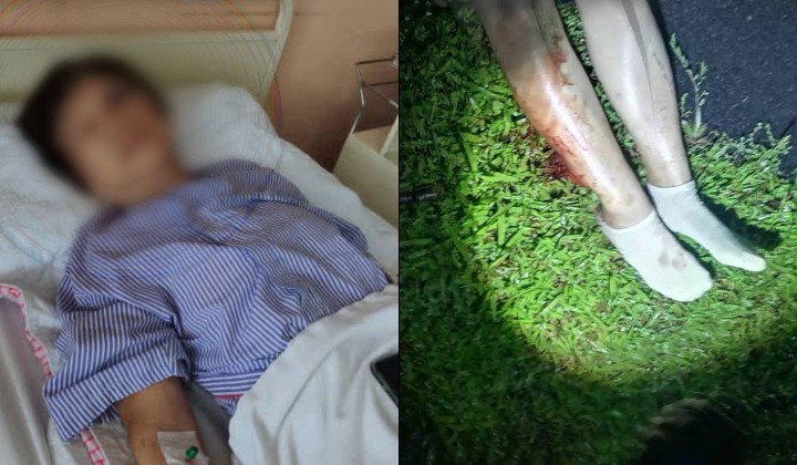 Perak Family Pleads For Answers After 60-Year-Old Mother Seriously Hurt In Hit-and-Run