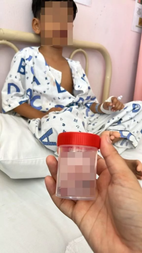 Young Boy Loses All Teeth Due To Poor Oral Hygiene