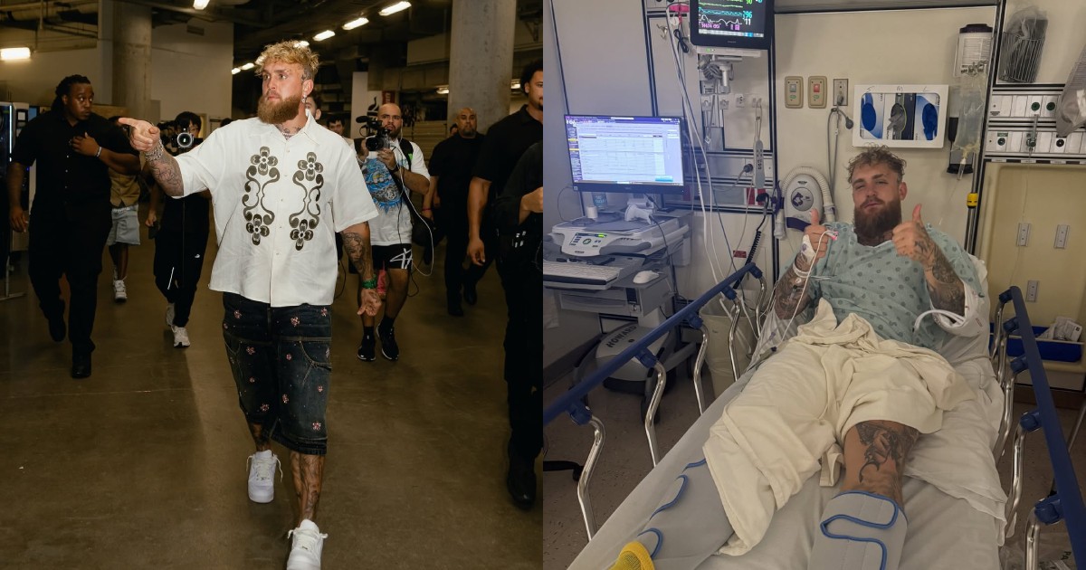 Jake Paul inserts 2 titanium plates into jaw during surgery