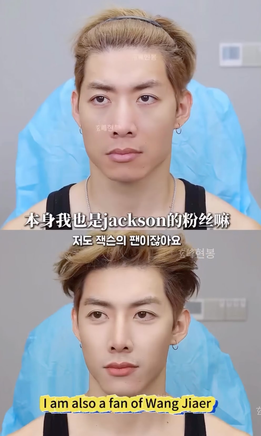 Jackson Wang Fan Got Surgery to Look Like Jackson Wang