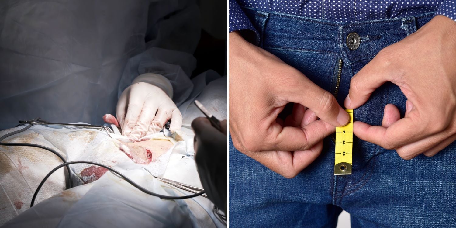 Ouch! Surgery went wrong, causing man’s penis to shrink and... 😳​🙈
