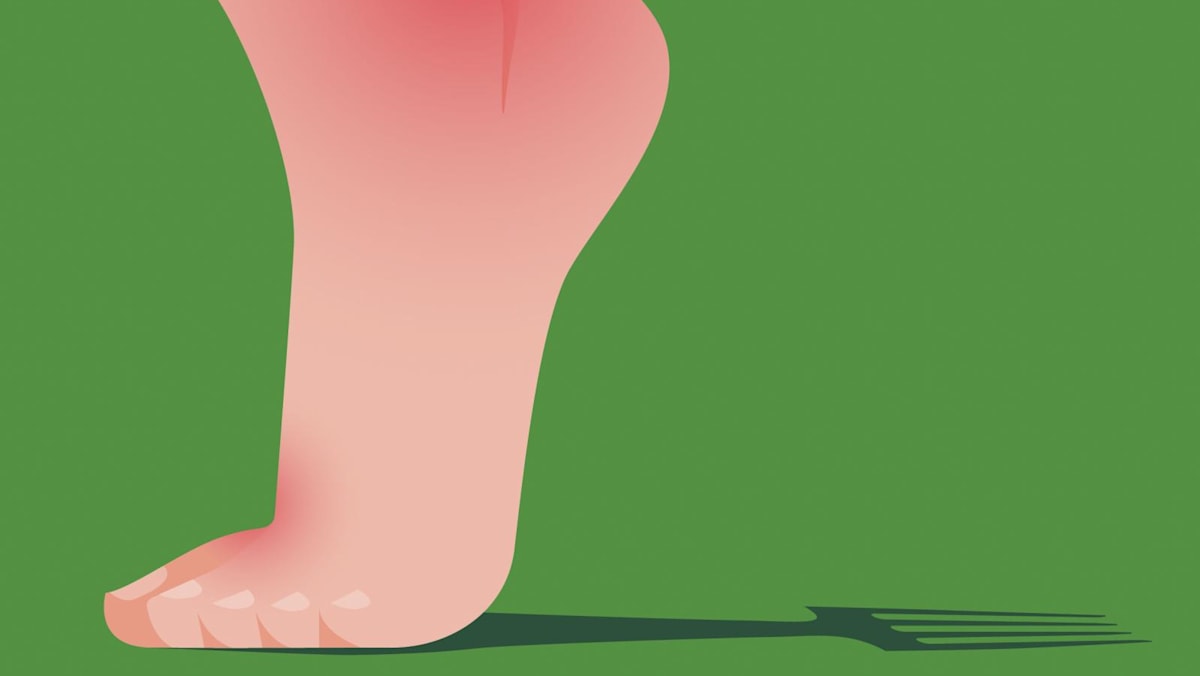 More people are getting this painful disease called gout! BUT what exactly is gout? 