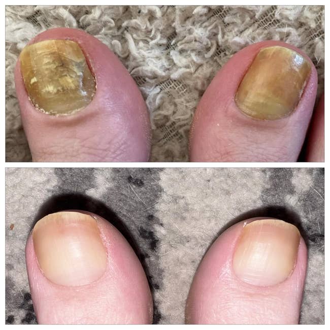 Take A Lesson From These 29 Reviewers Who Wish They’d Tried These 29 Personal Care Products Sooner